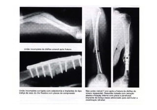 figura
10/12/2015 Dr. José Heitor M.Fernandes 68
 