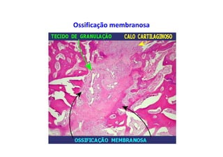 Ossificação membranosa
 