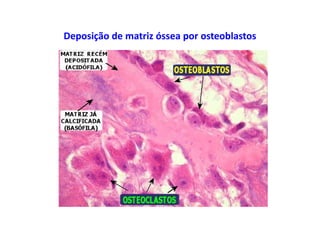 Deposição de matriz óssea por osteoblastos
 