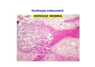 Ossificação endocondral
 
