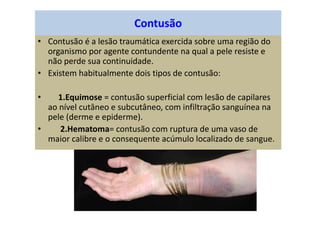 Contusão
• Contusão é a lesão traumática exercida sobre uma região do
organismo por agente contundente na qual a pele resiste e
não perde sua continuidade.
• Existem habitualmente dois tipos de contusão:
• 1.Equimose = contusão superficial com lesão de capilares
ao nível cutâneo e subcutâneo, com infiltração sanguínea na
pele (derme e epiderme).
• 2.Hematoma= contusão com ruptura de uma vaso de
maior calibre e o consequente acúmulo localizado de sangue.
 