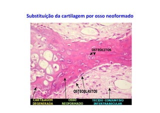 Substituíção da cartilagem por osso neoformado
 
