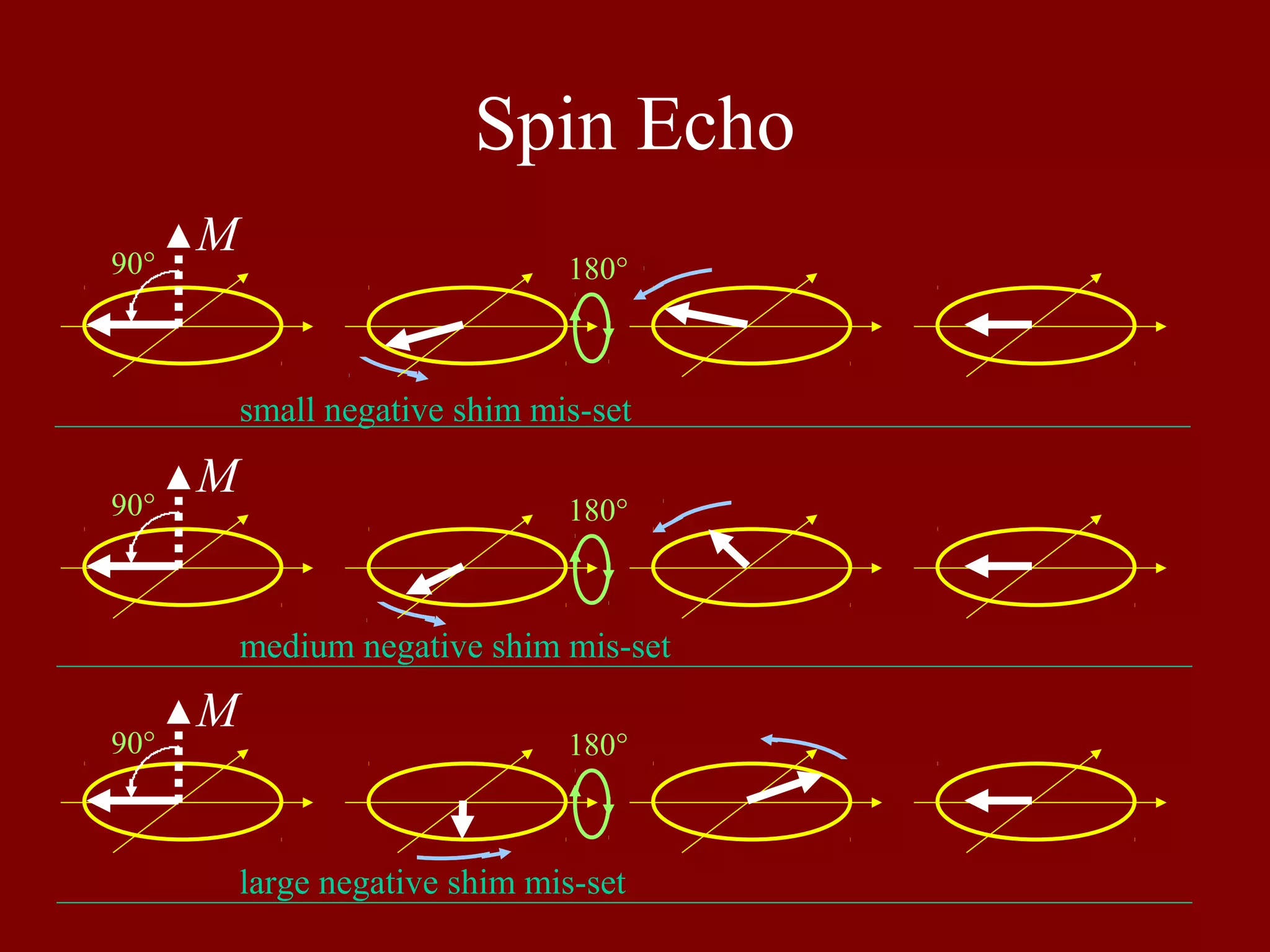 Spin Echo
M
M
M
180°
180°
180°90°
90°
90°
small negative shim mis-set
medium negative shim mis-set
large negative shim mis-set