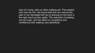 Use of a cane, stick or other walking aid. This patient,
who has hip OA, has found that she can reduce the
pain in her damaged left hip by leaning on the stick in
the right hand as she walks. The reduction in loading
can be huge, and the effect on symptoms and
confidence with walking very beneficial.
 