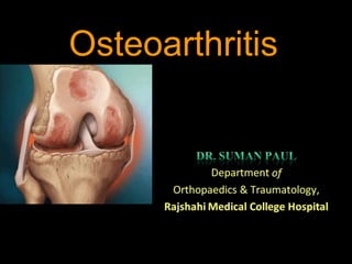 Osteoarthritis
 