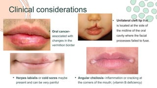 OA-LEC-1-Introduction-oral-cavity-and-paraoral-tissues.pdf