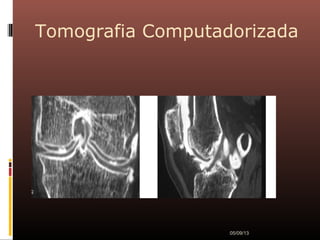Tomografia Computadorizada
05/09/13
 