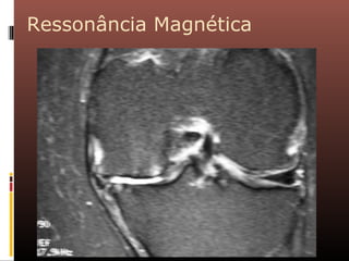 Ressonância Magnética
05/09/13
 