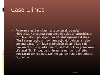 Caso Clínico
 Ao exame está em bom estado geral, corada,
hidratada. Apresenta pequenos nódulos endurecidos e
com leve dor a palpação em interfalangeanas distais
(Fig 1) crepitação à movimentação do polegar direito
em sua base. Tem leve diminuição de amplitude de
movimentos do quadril direito, sem dor. Tem geno varo
bilateral (fig 2), pequeno derrame no joelho direito,
crepitação em joelhos. Diminuição de flexão em ambos
os joelhos.
05/09/13
 