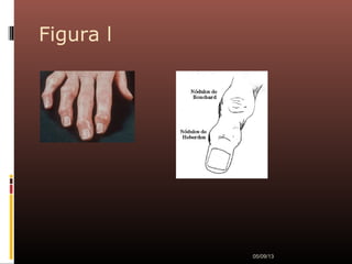 Figura l
05/09/13
 