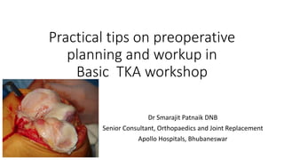 Practical tips on preoperative
planning and workup in
Basic TKA workshop
Dr Smarajit Patnaik DNB
Senior Consultant, Orthopaedics and Joint Replacement
Apollo Hospitals, Bhubaneswar
 