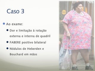 Caso 3
 Ao exame:
  Dor e limitação à rotação
   externa e interna de quadril

  FABERE positivo bilateral
  Nódulos de Heberden e
   Bouchard em mãos
 