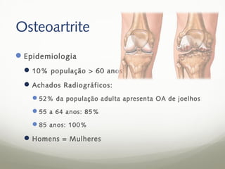 Osteoartrite
 Epidemiologia
   10% população > 60 anos
   Achados Radiográficos:
    52% da população adulta apresenta OA de joelhos
    55 a 64 anos: 85%
    85 anos: 100%

   Homens = Mulheres
 