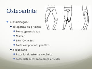 Osteoartrite
 Classificação:
   Idiopática ou primária:
     Forma generalizada
     Mulher
     85% OA mãos
     Forte componente genético
   Secundária
     Fator local: estresse mecânico
     Fator sistêmico: sobrecarga articular
 