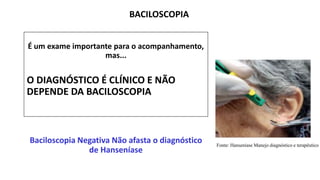 É um exame importante para o acompanhamento,
mas...
O DIAGNÓSTICO É CLÍNICO E NÃO
DEPENDE DA BACILOSCOPIA
Baciloscopia Negativa Não afasta o diagnóstico
de Hanseníase
BACILOSCOPIA
Fonte: Hanseníase Manejo diagnóstico e terapêutico
 