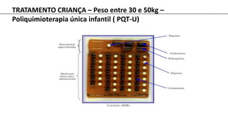TRATAMENTO CRIANÇA – Peso entre 30 e 50kg –
Poliquimioterapia única infantil ( PQT-U)
 