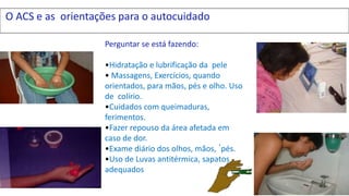 O ACS e as orientações para o autocuidado
Perguntar se está fazendo:
•Hidratação e lubrificação da pele
• Massagens, Exercícios, quando
orientados, para mãos, pés e olho. Uso
de colírio.
•Cuidados com queimaduras,
ferimentos.
•Fazer repouso da área afetada em
caso de dor.
•Exame diário dos olhos, mãos, ´pés.
•Uso de Luvas antitérmica, sapatos
adequados
 