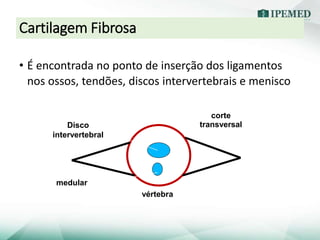 Cartilagem Fibrosa
• É encontrada no ponto de inserção dos ligamentos
nos ossos, tendões, discos intervertebrais e menisco
vértebra
Disco
intervertebral
Canal
medular
corte
transversal
 
