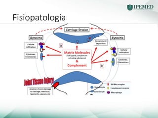 Fisiopatologia
 