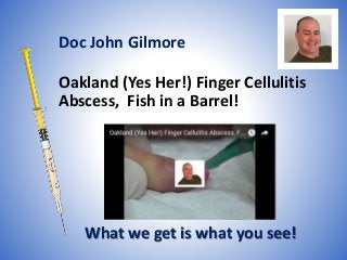 Oakland (Yes Her!) Finger Cellulitis
Abscess, Fish in a Barrel!
What we get is what you see!
Doc John Gilmore
 