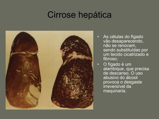 Cirrose hepática As células do fígado vão desaparecendo, não se renovam, sendo substituídas por um tecido cicatrizado e fibroso;  O fígado é um alambique, que precisa de descanso. O uso abusivo do álcool provoca o desgaste irreversível da maquinaria.  