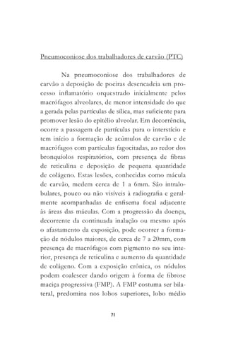 71
Pneumoconiose dos trabalhadores de carvão (PTC)
Na pneumoconiose dos trabalhadores de
carvão a deposição de poeiras desencadeia um pro-
cesso inflamatório orquestrado inicialmente pelos
macrófagos alveolares, de menor intensidade do que
a gerada pelas partículas de sílica, mas suficiente para
promover lesão do epitélio alveolar. Em decorrência,
ocorre a passagem de partículas para o interstício e
tem início a formação de acúmulos de carvão e de
macrófagos com partículas fagocitadas, ao redor dos
bronquíolos respiratórios, com presença de fibras
de reticulina e deposição de pequena quantidade
de colágeno. Estas lesões, conhecidas como mácula
de carvão, medem cerca de 1 a 6mm. São intralo-
bulares, pouco ou não visíveis à radiografia e geral-
mente acompanhadas de enfisema focal adjacente
às áreas das máculas. Com a progressão da doença,
decorrente da continuada inalação ou mesmo após
o afastamento da exposição, pode ocorrer a forma-
ção de nódulos maiores, de cerca de 7 a 20mm, com
presença de macrófagos com pigmento no seu inte-
rior, presença de reticulina e aumento da quantidade
de colágeno. Com a exposição crônica, os nódulos
podem coalescer dando origem à forma de fibrose
maciça progressiva (FMP). A FMP costuma ser bila-
teral, predomina nos lobos superiores, lobo médio
 
