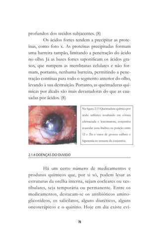 79
profundos dos tecidos subjacentes. (8)
Os ácidos fortes tendem a precipitar as prote-
ínas, como foto x. As proteínas precipitadas formam
uma barreira tampão, limitando a penetração do ácido
no olho. Já as bases fortes saponificam os ácidos gra-
xos, que rompem as membranas celulares e não for-
mam, portanto, nenhuma barreira, permitindo a pene-
tração contínua para todo o segmento anterior do olho,
levando à sua destruição. Portanto, as queimaduras quí-
micas por álcalis são mais devastadoras do que as cau-
sadas por ácidos. (8)
2.1.4 DOENÇAS DO OUVIDO
Há um certo número de medicamentos e
produtos químicos que, por si só, podem lesar as
estruturas da orelha interna, sejam cocleares ou ves-
tibulares, seja temporária ou permanente. Entre os
medicamentos, destacam-se os antibióticos amino-
glicosídeos, os salicilatos, alguns diuréticos, alguns
oncoterápicos e o quinino. Hoje em dia existe evi-
 