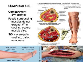 Compartment
Syndrome:
Fascia surrounding
muscles do not
expand. When
swelling occurs
muscle dies.
S/S: severe pain,
swelling, pallor,
numbness
COMPLICATIONS
 