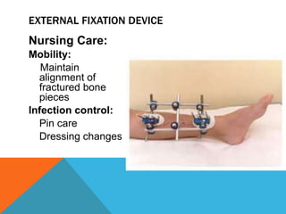 Nursing Care:
Mobility:
Maintain
alignment of
fractured bone
pieces
Infection control:
Pin care
Dressing changes
EXTERNAL FIXATION DEVICE
 