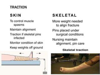 TRACTION
SKIN
To control muscle
spasms
Maintain alignment
Traction if skeletal pins
infected
Monitor condition of skin
Keep weights off ground
SKELETAL
More weight needed
to align fracture
Pins placed under
surgical conditions
Nursing maintain
alignment, pin care
 