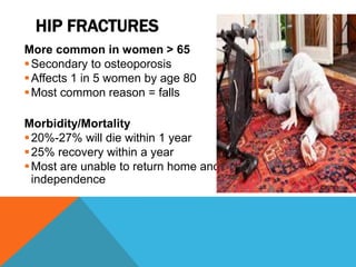 HIP FRACTURES
More common in women > 65
Secondary to osteoporosis
Affects 1 in 5 women by age 80
Most common reason = falls
Morbidity/Mortality
20%-27% will die within 1 year
25% recovery within a year
Most are unable to return home and
independence
 