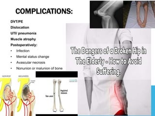 COMPLICATIONS:
DVT/PE
Dislocation
UTI/ pneumonia
Muscle atrophy
Postoperatively:
• Infection
• Mental status change
• Avascular necrosis
• Nonunion or malunion of bone
 