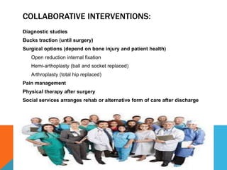 COLLABORATIVE INTERVENTIONS:
Diagnostic studies
Bucks traction (until surgery)
Surgical options (depend on bone injury and patient health)
Open reduction internal fixation
Hemi-arthoplasty (ball and socket replaced)
Arthroplasty (total hip replaced)
Pain management
Physical therapy after surgery
Social services arranges rehab or alternative form of care after discharge
 
