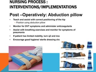 NURSING PROCESS :
INTERVENTIONS/IMPLEMENTATIONS
Post –Operatively: Abduction pillow
• Teach and assist with correct positioning of the hip
• Position using abduction pillow
• Monitor for DVT symptoms and administer anticoagulants
• Assist with breathing exercises and monitor for symptoms of
pneumonia
• If patient has limited mobility, turn q2 and monitor condition of skin.
• Encourage good hygiene/ sterile dressing changes
 