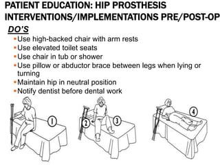 PATIENT EDUCATION: HIP PROSTHESIS
INTERVENTIONS/IMPLEMENTATIONS PRE/POST-OP
DO’S
Use high-backed chair with arm rests
Use elevated toilet seats
Use chair in tub or shower
Use pillow or abductor brace between legs when lying or
turning
Maintain hip in neutral position
Notify dentist before dental work
Notify MD if severe pain or loss of function
 