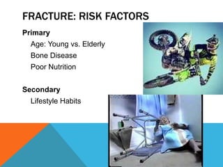 FRACTURE: RISK FACTORS
Primary
Age: Young vs. Elderly
Bone Disease
Poor Nutrition
Secondary
Lifestyle Habits
 