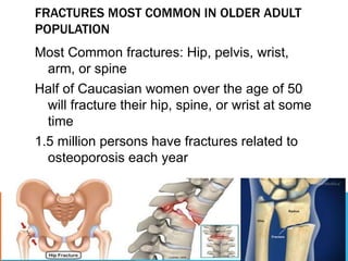 FRACTURES MOST COMMON IN OLDER ADULT
POPULATION
Most Common fractures: Hip, pelvis, wrist,
arm, or spine
Half of Caucasian women over the age of 50
will fracture their hip, spine, or wrist at some
time
1.5 million persons have fractures related to
osteoporosis each year
 