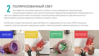Как известно, на головке мужского полового члена наблюдается самая большая
концентрация нервных окончаний в организме. Переменное воздействие поляризованного
света на нервные окончания способствует значительному повышению их чувствительности и
обеспечивает усиление кровотока в области полового члена.
Синий свет снимает воспаления, красный борется с инфекциями (в том числе, ИППП на ранних
стадиях), зеленый улучшает циркуляцию крови, а жёлтый ускоряет нервные импульсы и сигналы.
2 ПОЛЯРИЗОВАННЫЙ СВЕТ
 