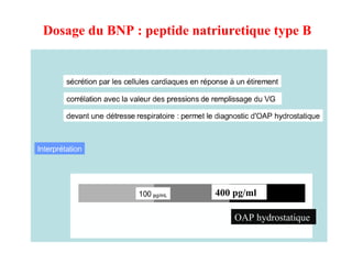 Dosage du BNP : peptide natriuretique type B
OAP hydrostatique
400 pg/ml
 