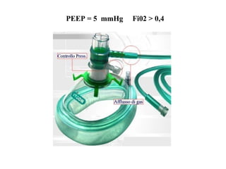 PEEP = 5 mmHg Fi02 > 0,4
 