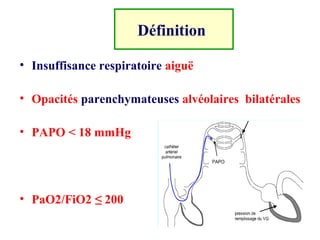 • Insuffisance respiratoire aiguë
• Opacités parenchymateuses alvéolaires bilatérales
• PAPO < 18 mmHg
• PaO2/FiO2 ≤ 200
Définition
 