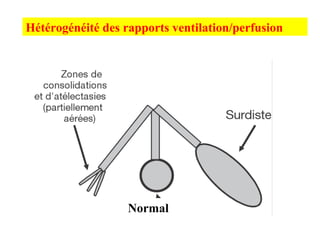 Normal
Hétérogénéité des rapports ventilation/perfusion
 