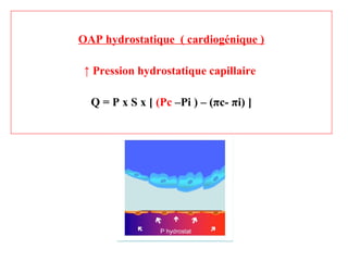 OAP hydrostatique ( cardiogénique )
↑ Pression hydrostatique capillaire
Q = P x S x [ (Pc –Pi ) – (πc- πi) ]
 