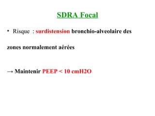 SDRA Focal
• Risque : surdistension bronchio-alveolaire des
zones normalement aérées
→ Maintenir PEEP < 10 cmH2O
 