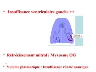 • Insuffisance ventriculaire gauche ++
• Rétrécissement mitral / Myxoeme OG
• Volume plasmatique : Insuffisance rénale anurique
 