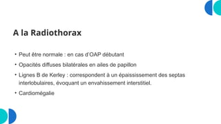 A la Radiothorax
• Peut être normale : en cas d’OAP débutant
• Opacités diffuses bilatérales en ailes de papillon
• Lignes B de Kerley : correspondent à un épaississement des septas
interlobulaires, évoquant un envahissement interstitiel.
• Cardiomégalie
 