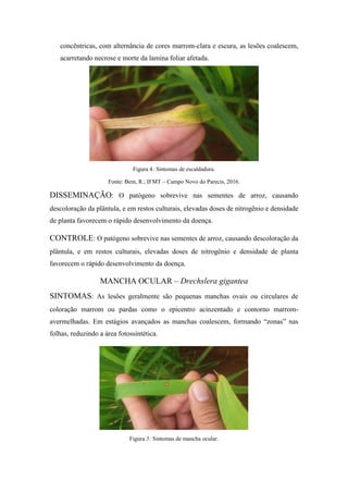 concêntricas, com alternância de cores marrom-clara e escura, as lesões coalescem,
acarretando necrose e morte da lamina foliar afetada.
Figura 4: Sintomas de escaldadura.
Fonte: Bem, R.; IFMT – Campo Novo do Parecis, 2016.
DISSEMINAÇÃO: O patógeno sobrevive nas sementes de arroz, causando
descoloração da plântula, e em restos culturais, elevadas doses de nitrogênio e densidade
de planta favorecem o rápido desenvolvimento da doença.
CONTROLE: O patógeno sobrevive nas sementes de arroz, causando descoloração da
plântula, e em restos culturais, elevadas doses de nitrogênio e densidade de planta
favorecem o rápido desenvolvimento da doença.
MANCHA OCULAR – Drechslera gigantea
SINTOMAS: As lesões geralmente são pequenas manchas ovais ou circulares de
coloração marrom ou pardas como o epicentro acinzentado e contorno marrom-
avermelhadas. Em estágios avançados as manchas coalescem, formando “zonas” nas
folhas, reduzindo a área fotossintética.
Figura 5: Sintomas de mancha ocular.
 