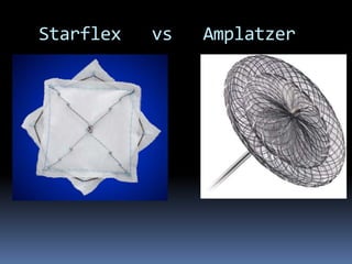 Starflex vs Amplatzer
 