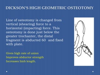 DICKSON’S HIGH GEOMETRIC OSTEOTOMYLine of osteotomy is changed from vertical (shearing) force to a horizontal (impacting) force. This osteotomy is done just below the greater trochanter, the distal fragment is abducted 60° and fixed with plate.Gives high rate of unionImproves abductor strengthIncreases limb length.
