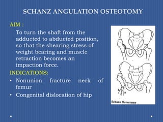 SCHANZ ANGULATION OSTEOTOMYAIM : 	To turn the shaft from the adducted to abducted position, so that the shearing stress of weight bearing and muscle retraction becomes an impaction force.INDICATIONS:Nonunion fracture neck of femurCongenital dislocation of hip